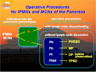 Operative Procedures for IPMNs and MCNs of the Pancreas