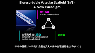 Bioresorbable Vascular Scaffold (BVS) A New Paradigm